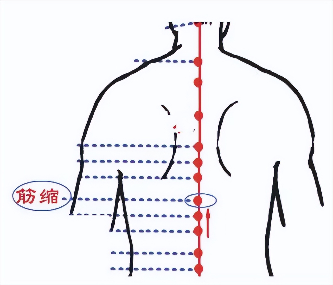 https://mp.toutiao.com/mp/agw/article_material/open_image/get?code=YjcwYWI2ZTZmNDg2MzJiYmE0ZWFhZjhlMTNkYWI3MGEsMTY3MDg0NDk5NDU1MA==